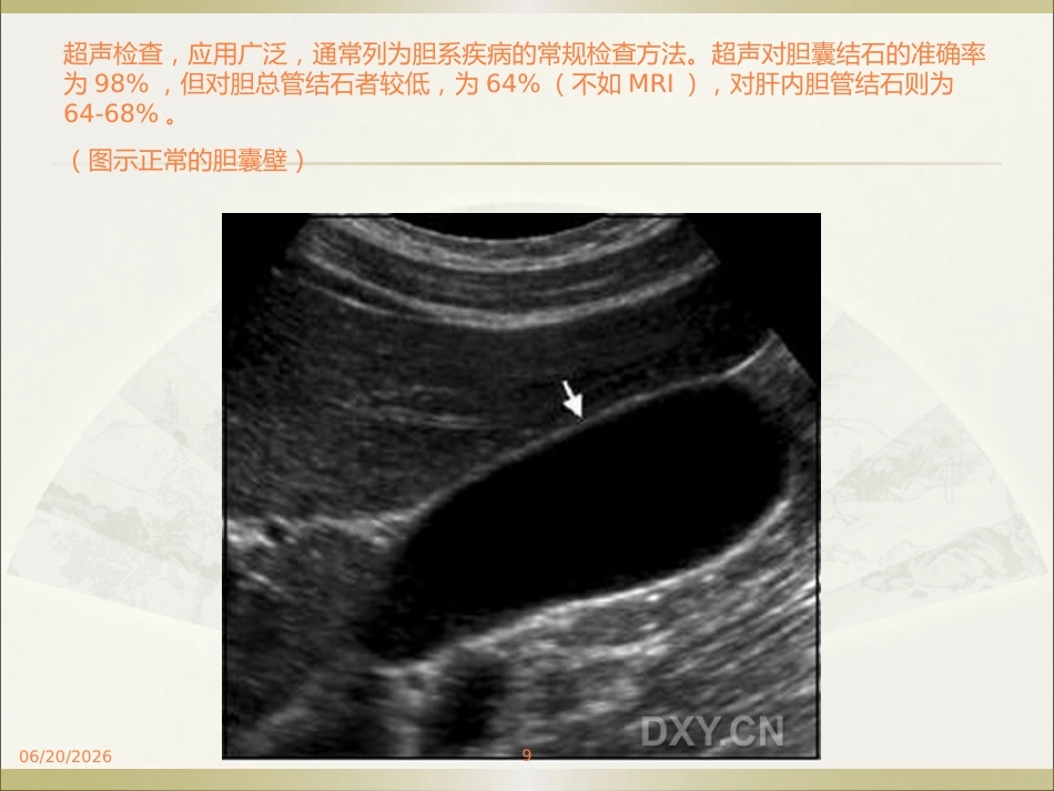 胆系疾病ppt课件_第9页