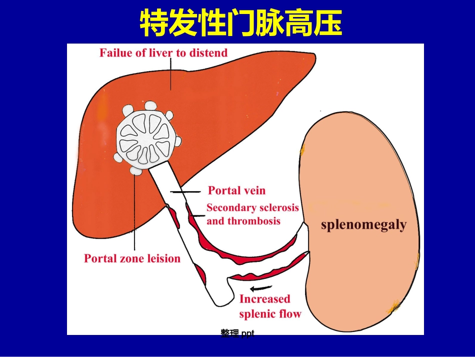 非肝硬化性门脉高压的诊断要点_第12页