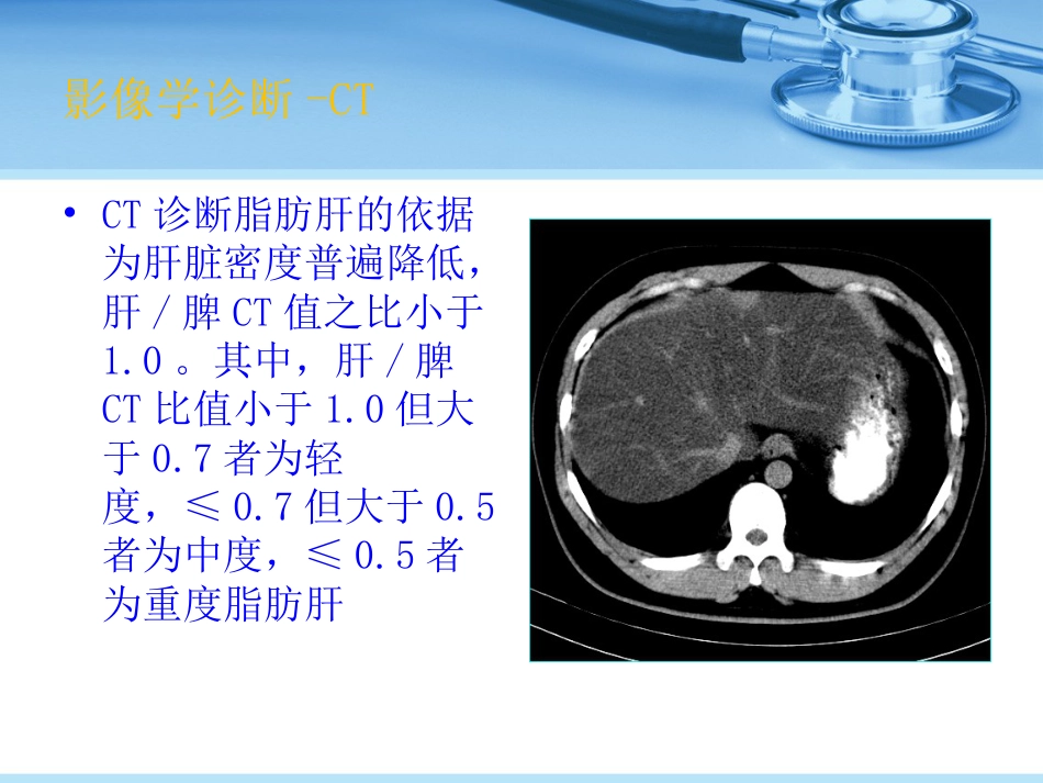 非酒精性脂肪性肝病_第11页