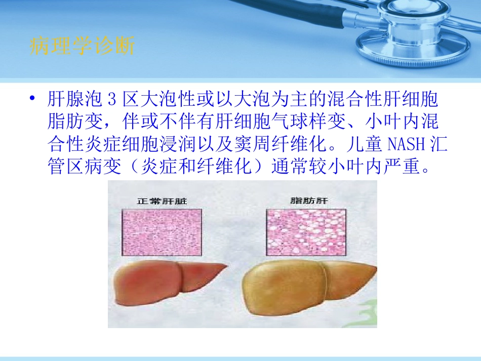 非酒精性脂肪性肝病_第7页