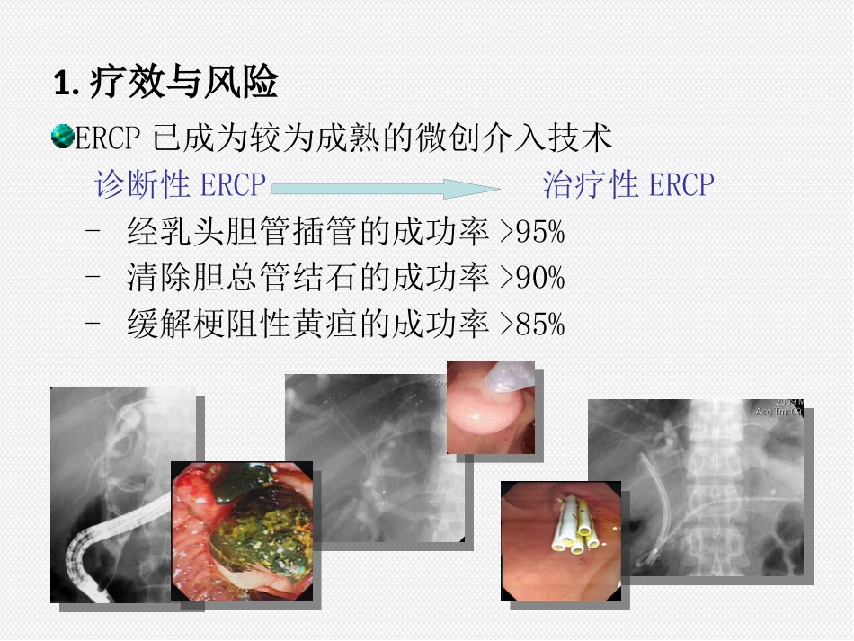 ERCP治疗胆胰疾病_第2页