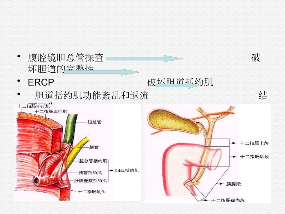 ERCP治疗胆胰疾病_第4页