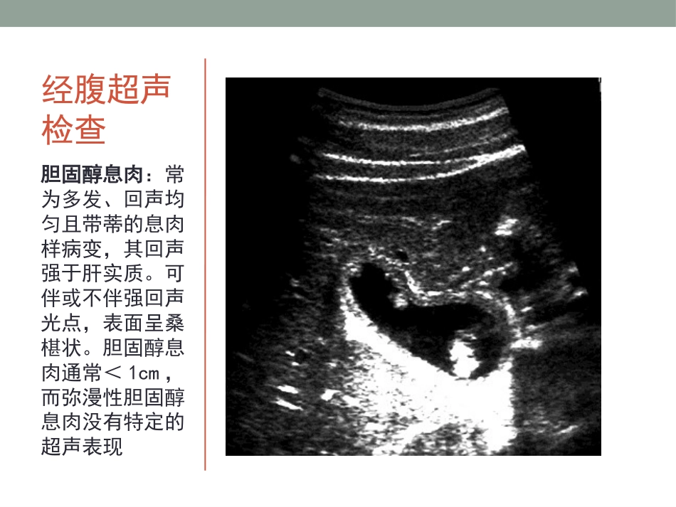 胆囊息肉的随访_第8页