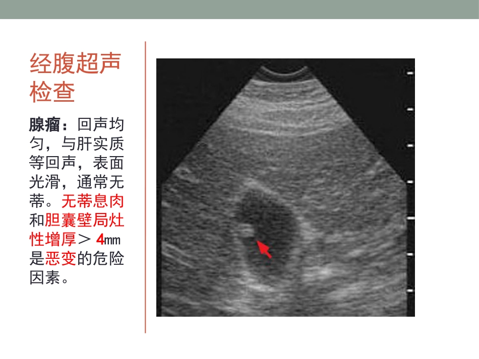胆囊息肉的随访_第9页