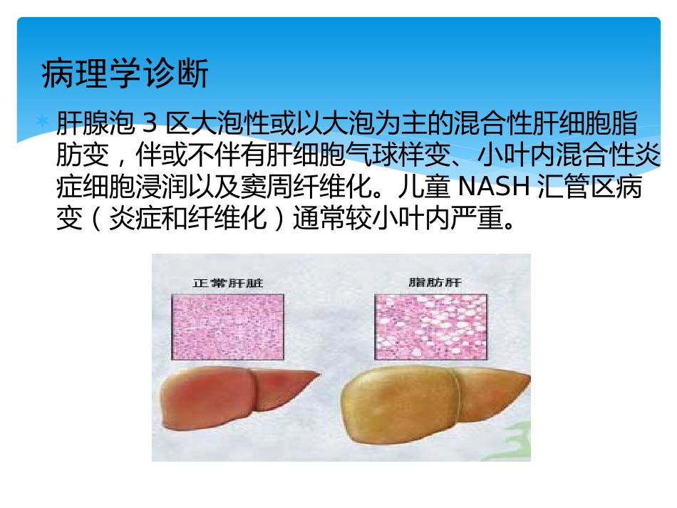 非酒精性脂肪性肝病评估_第6页
