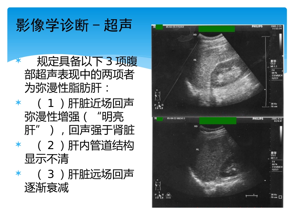非酒精性脂肪性肝病评估_第9页