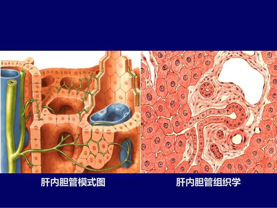 胆囊疾病PPT_第3页