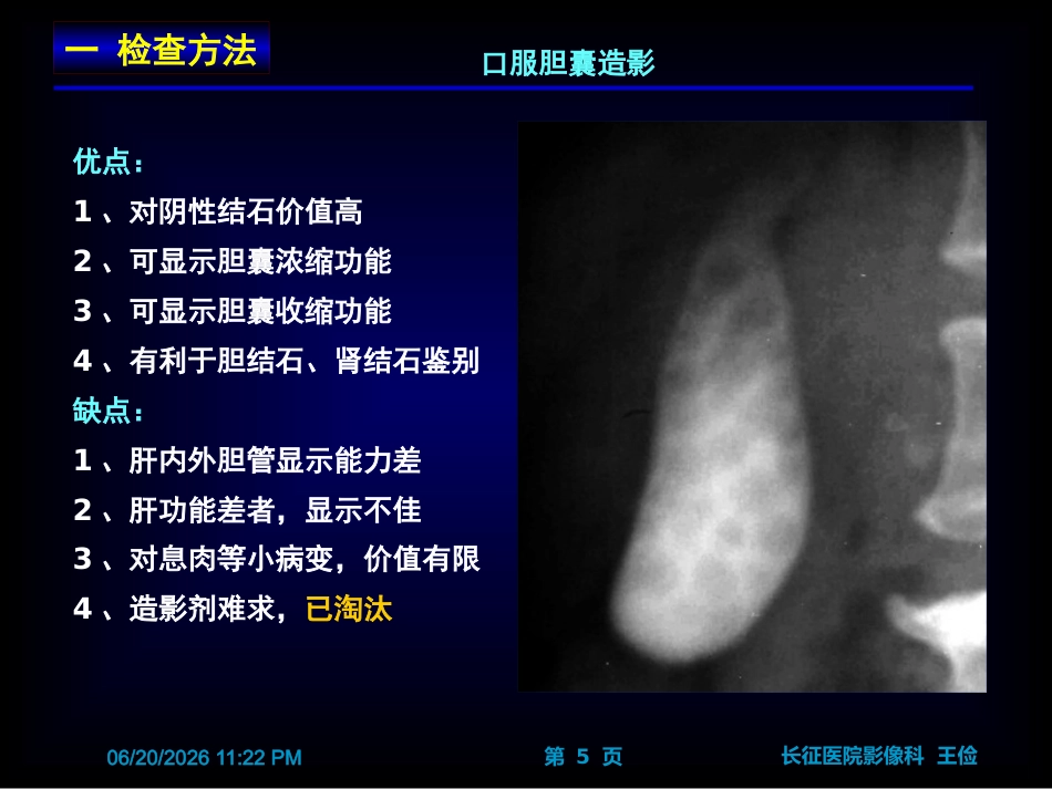 胆囊炎影像诊断PPT_第5页
