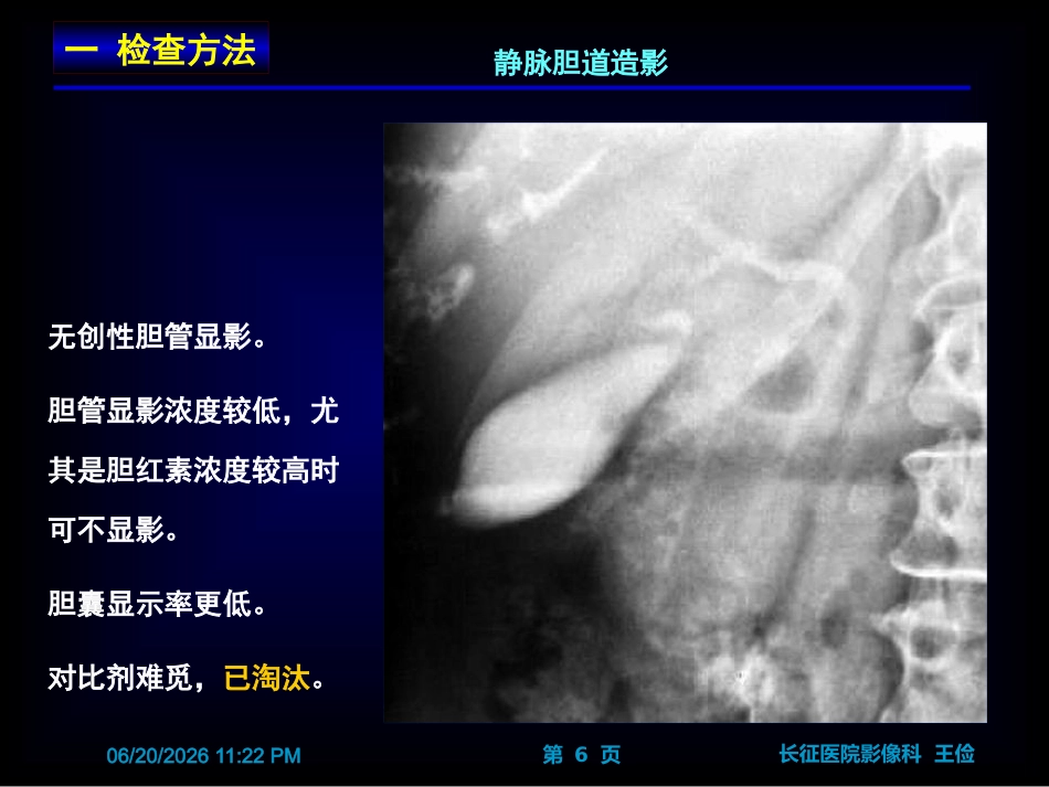 胆囊炎影像诊断PPT_第6页