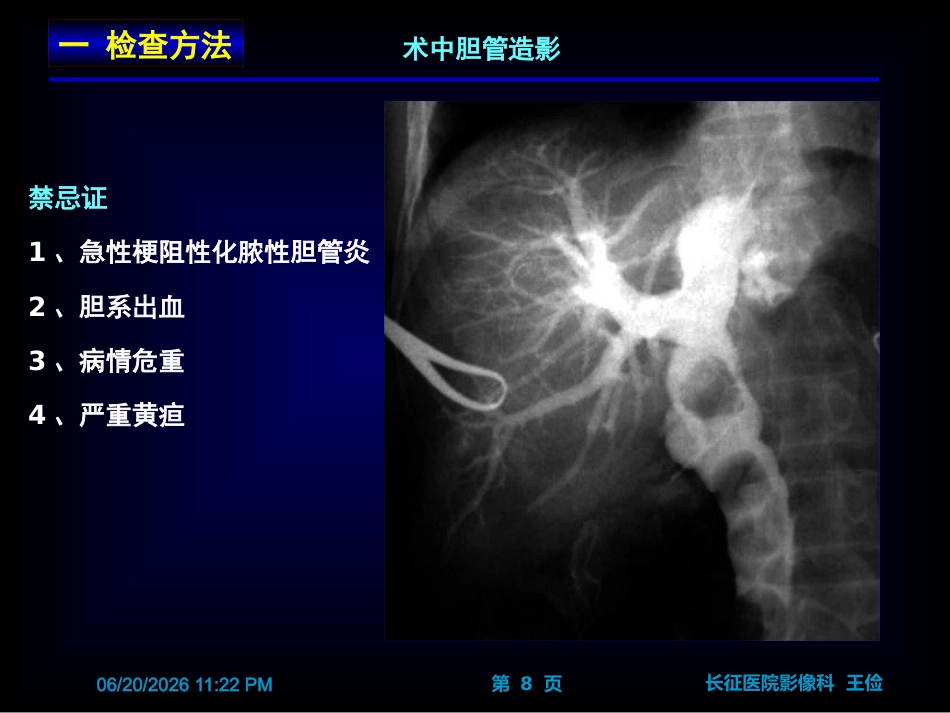 胆囊炎影像诊断PPT_第8页