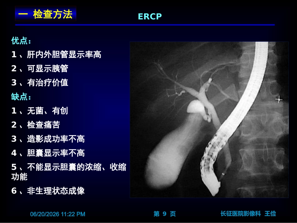 胆囊炎影像诊断PPT_第9页