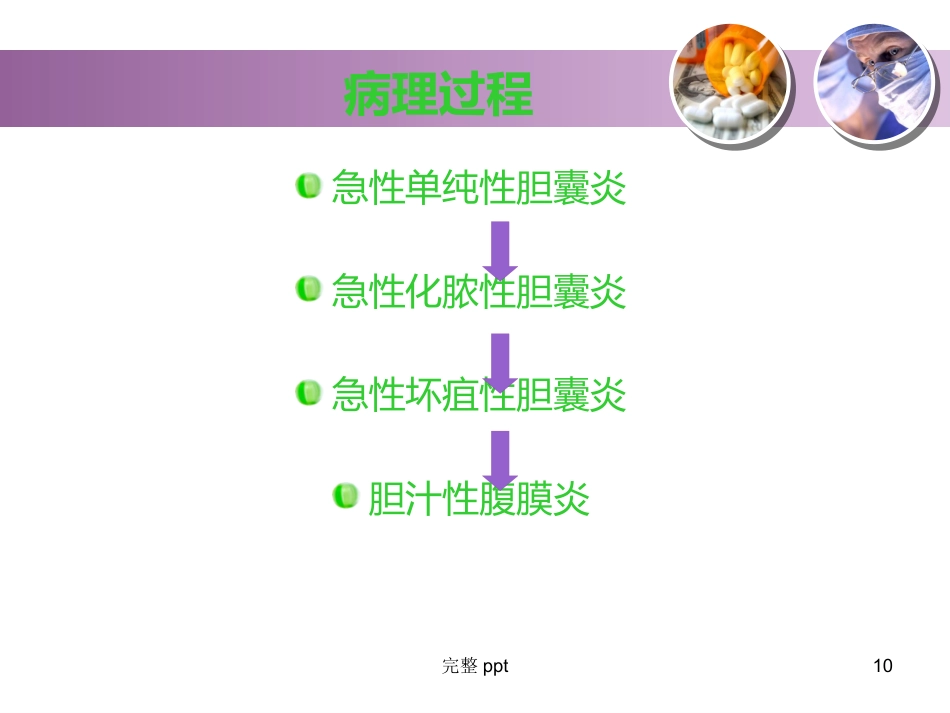 胆囊结石的教学查房_第10页