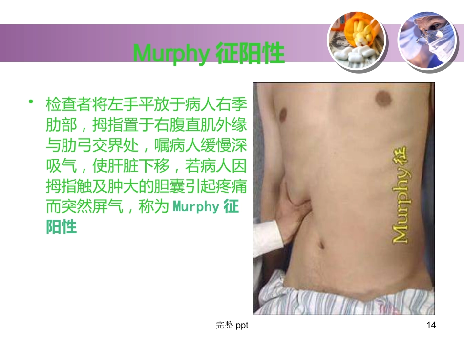 胆囊结石的教学查房_第14页