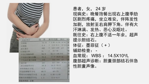 胆囊结石及胆囊炎超声诊断