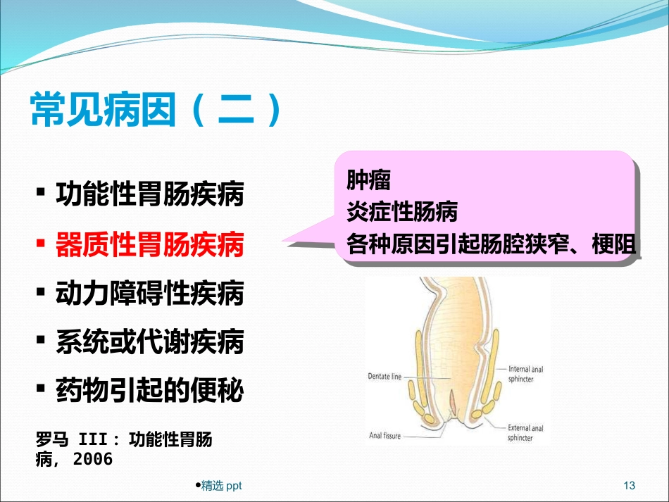 《慢性便秘的诊治》_第13页