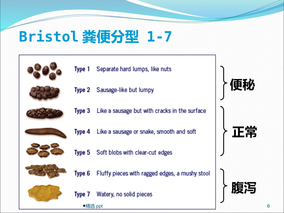 《慢性便秘的诊治》_第6页