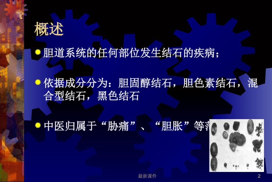 胆石症的中西医诊治最新_第2页