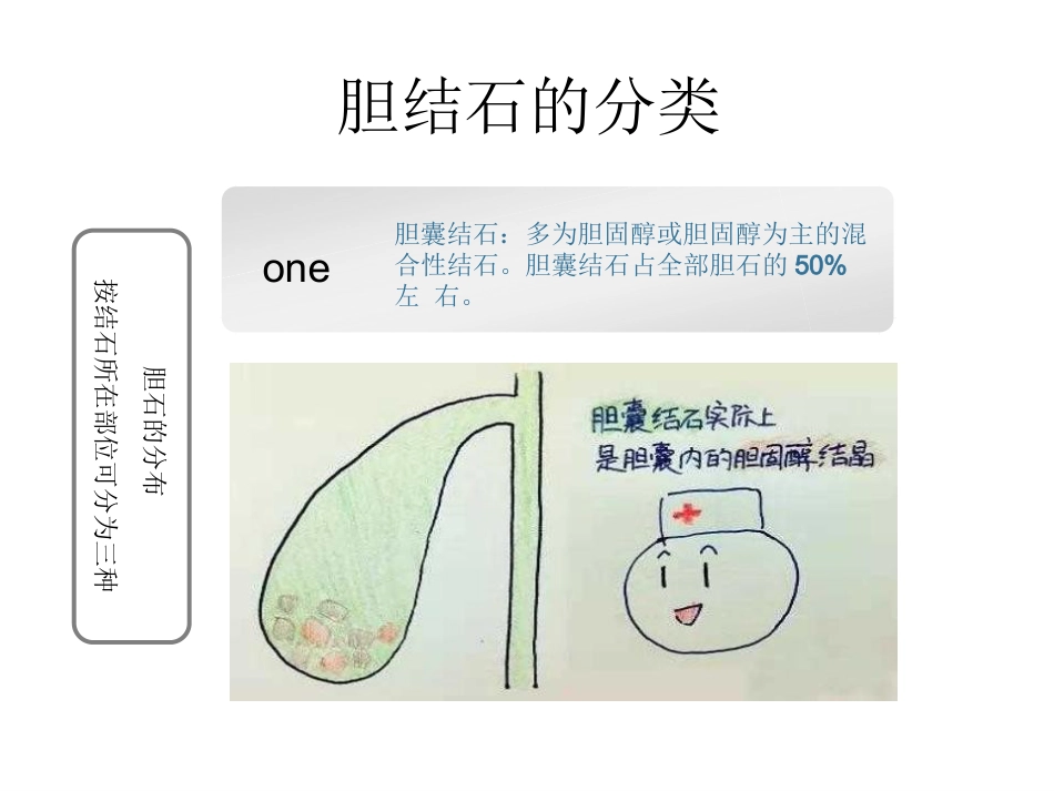 胆囊结石科普PPT幻灯片课件_第5页
