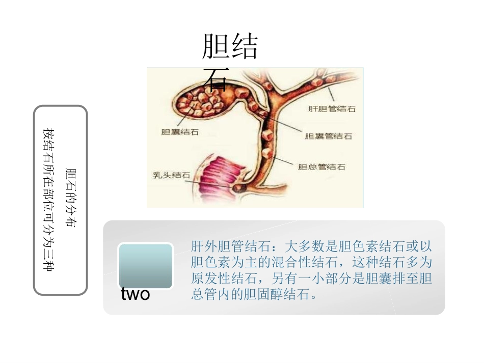 胆囊结石科普PPT幻灯片课件_第6页