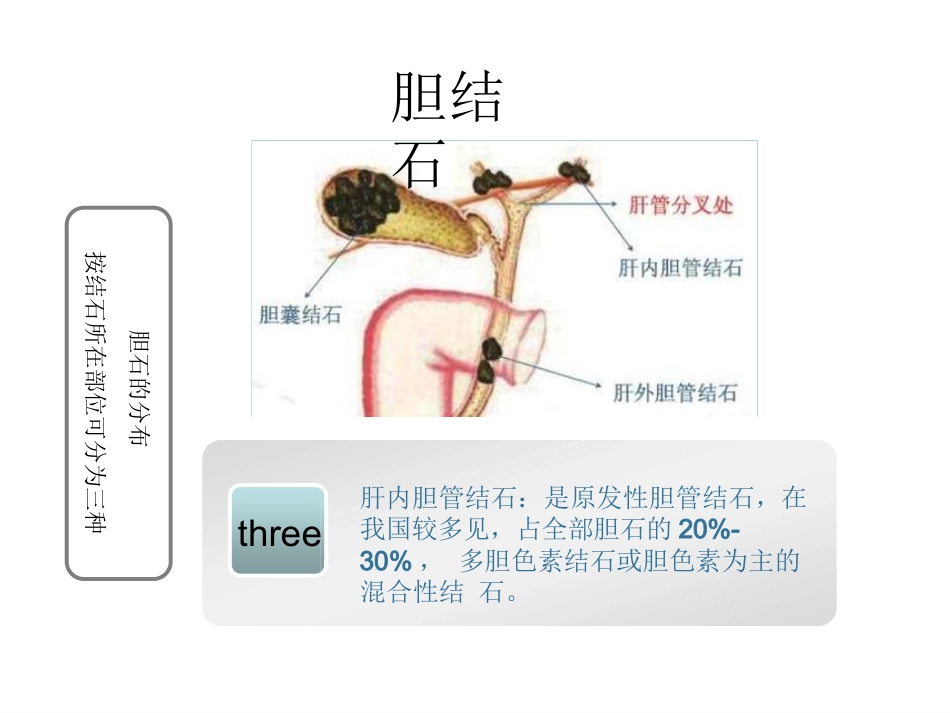 胆囊结石科普PPT幻灯片课件_第7页