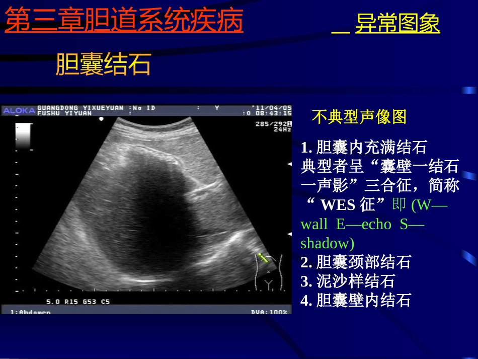 胆系疾病超声诊断(GY)_第13页