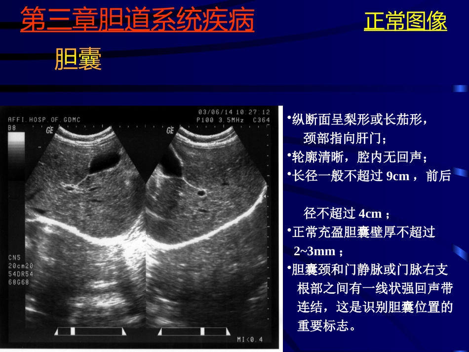 胆系疾病超声诊断(GY)_第9页
