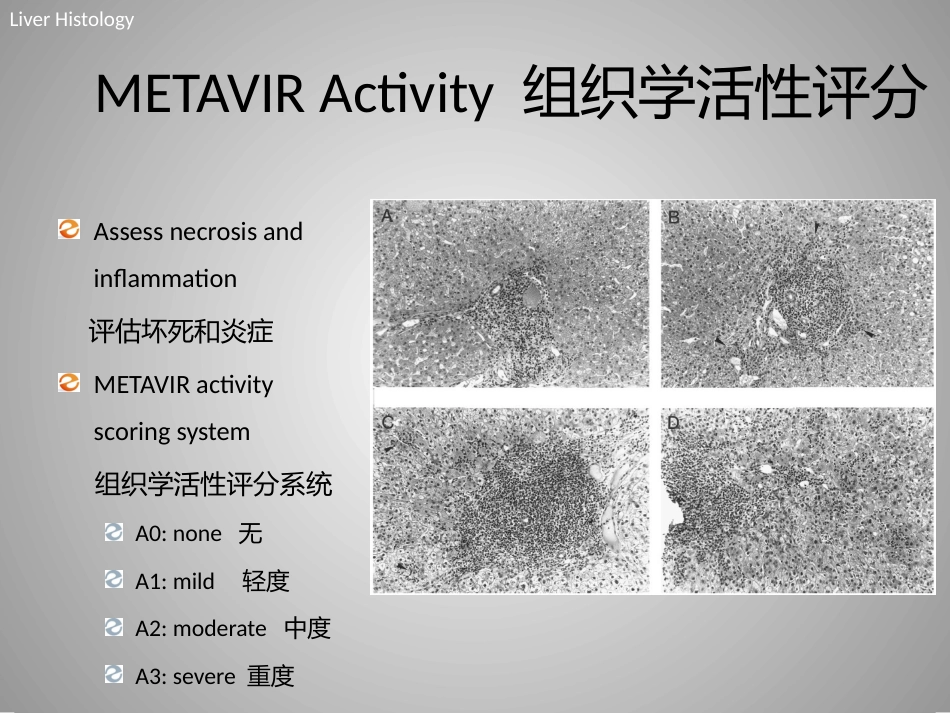 FibroScan在慢性肝病评估中的临床价值_第7页