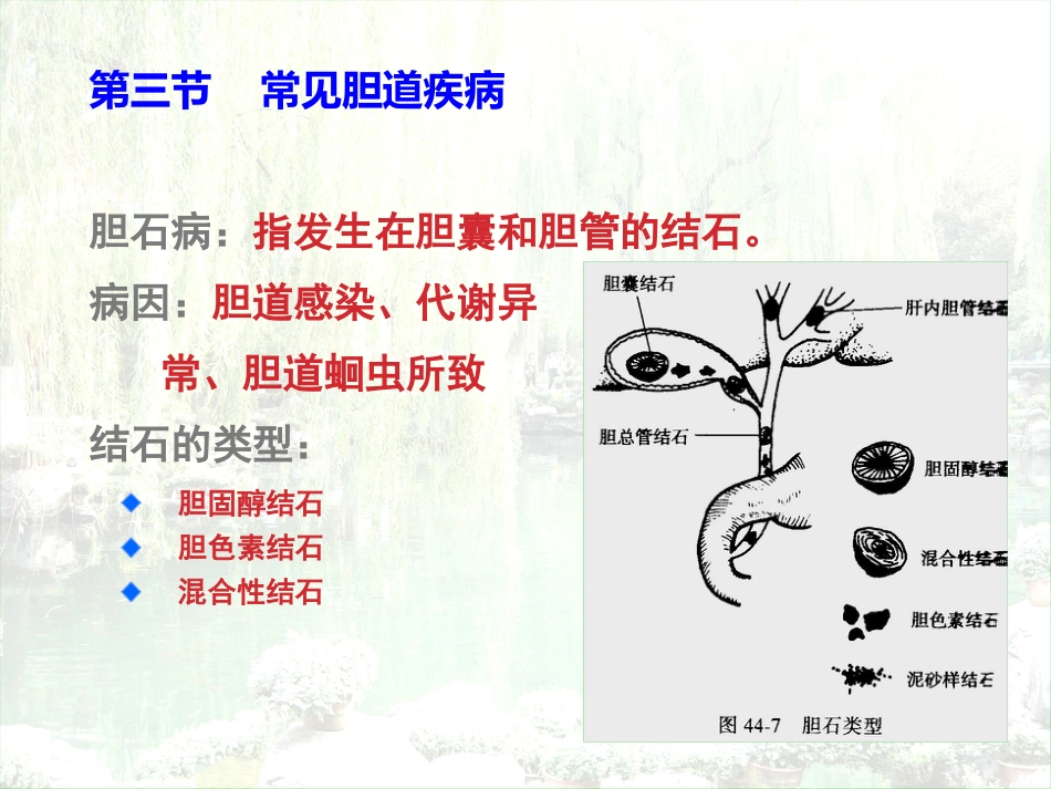 胆囊结石胆囊炎_第8页