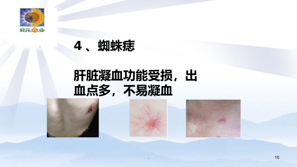 常见肝病诊治PPT课件_第10页