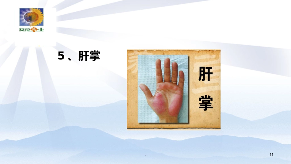 常见肝病诊治PPT课件_第11页