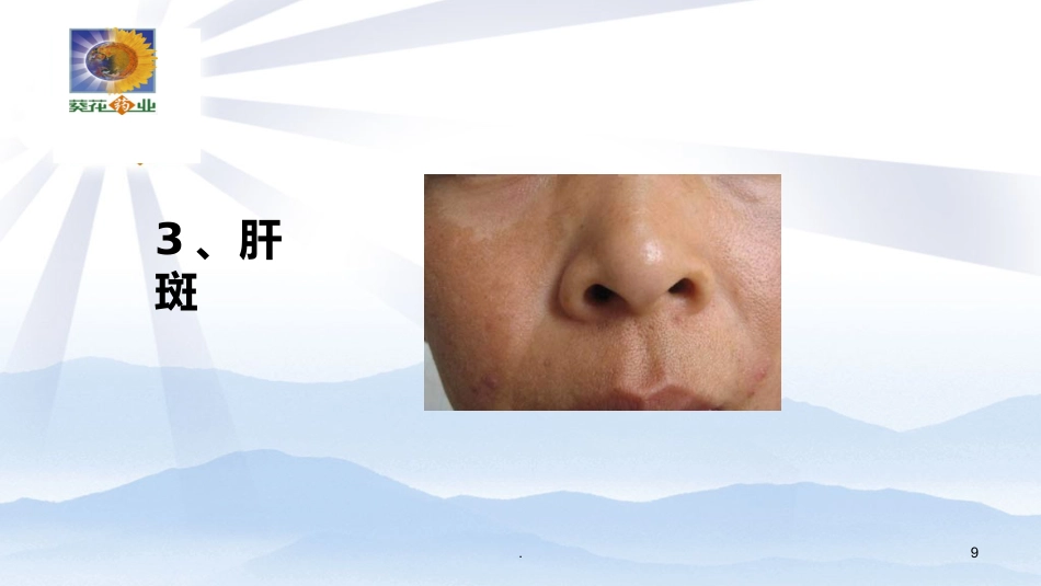 常见肝病诊治PPT课件_第9页