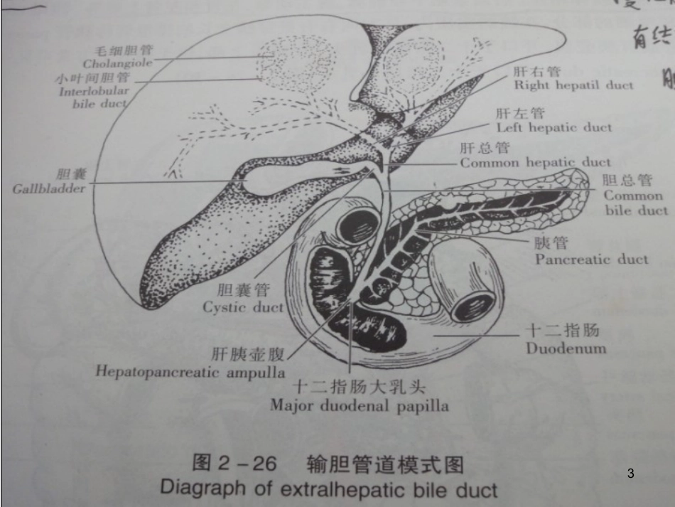 胆石病的诊断与治_第3页