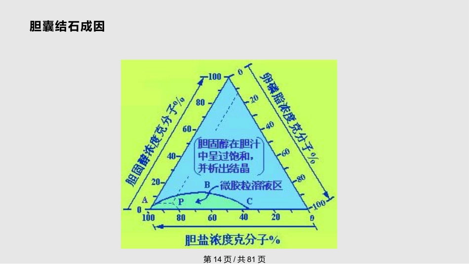 胆囊良性疾病的诊治PPT课件_第14页