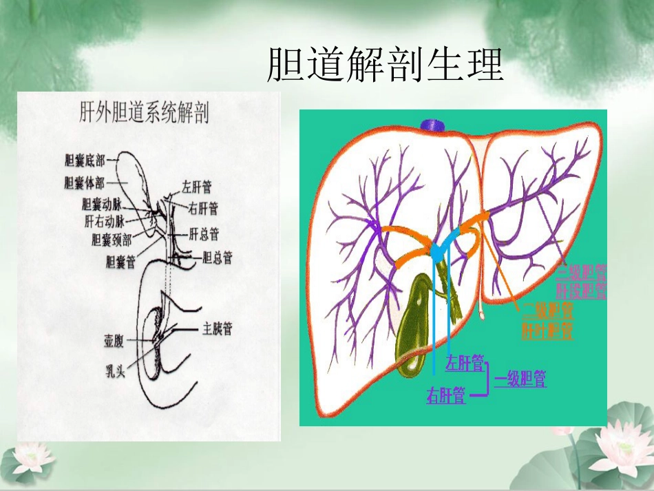 胆囊结石伴胆囊炎Ppt_第2页