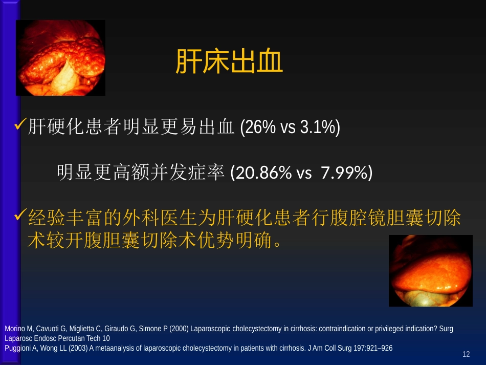 腹腔镜胆囊切除术后并发症的外科处理ppt课件_第11页