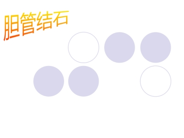 胆管结石