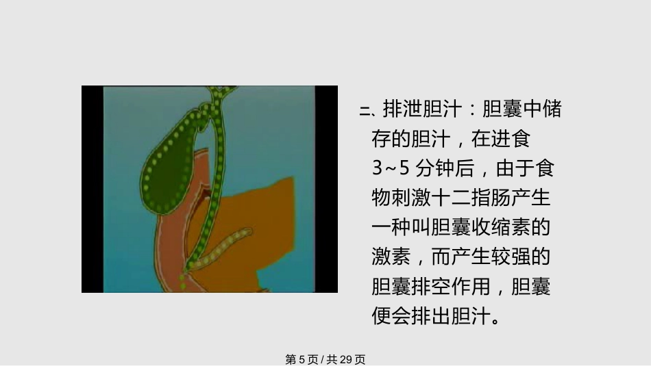 胆囊结石的治疗_第5页