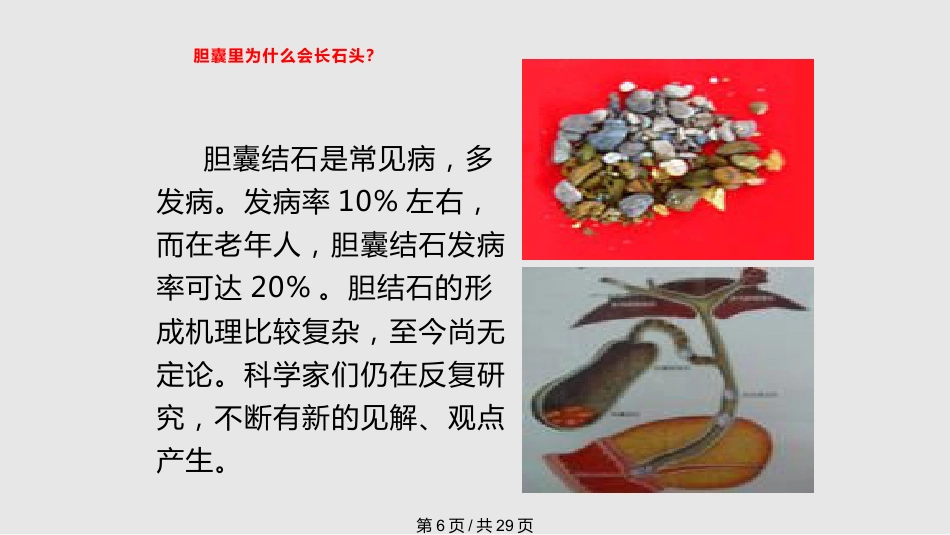 胆囊结石的治疗_第6页