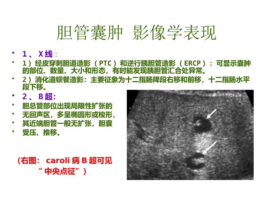 胆管囊肿_第10页