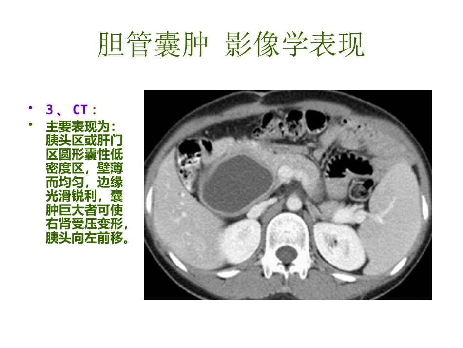 胆管囊肿_第11页