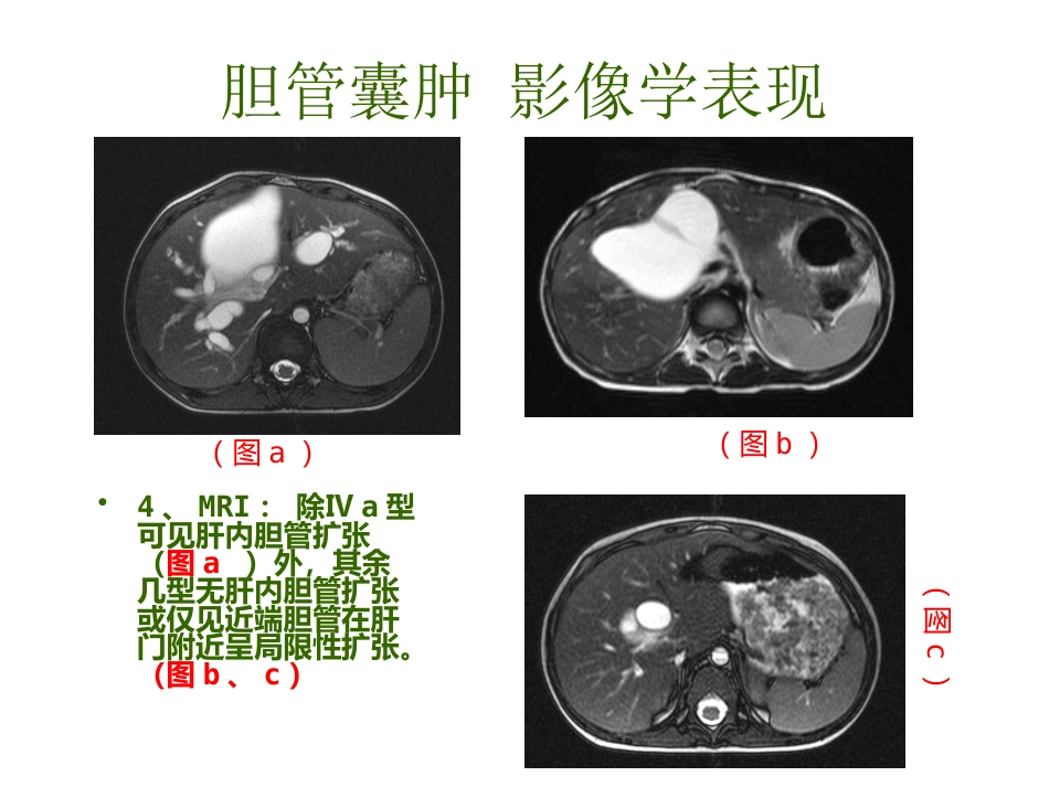胆管囊肿_第12页