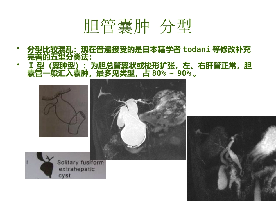 胆管囊肿_第4页