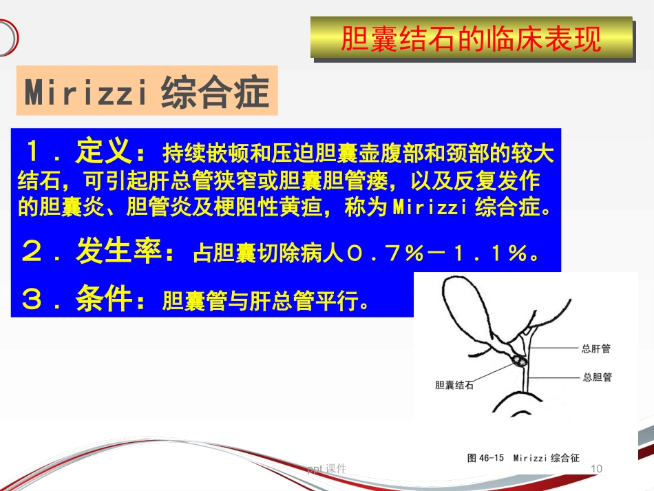 胆囊结石 ppt课件_第10页