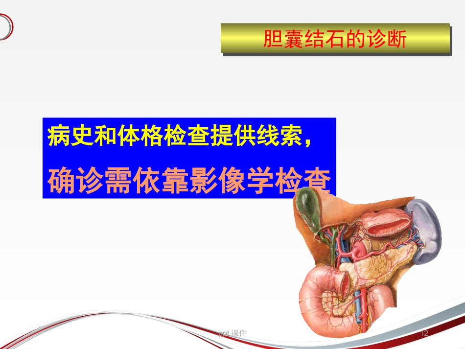 胆囊结石 ppt课件_第12页