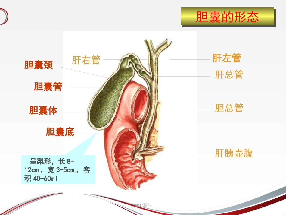胆囊结石 ppt课件_第3页