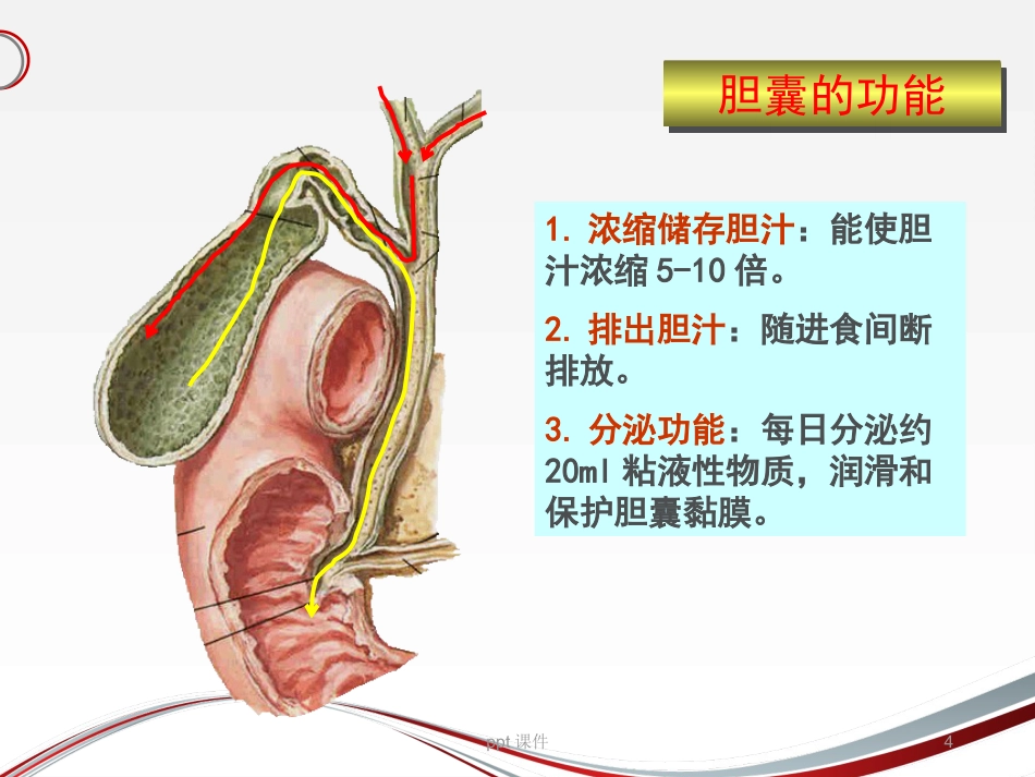 胆囊结石 ppt课件_第4页