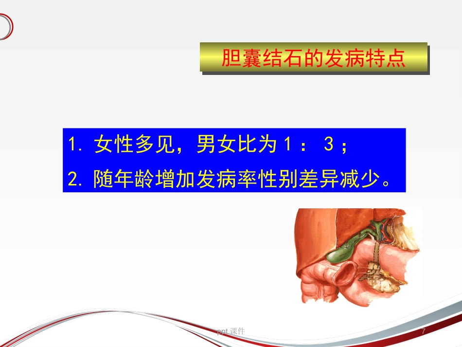 胆囊结石 ppt课件_第7页