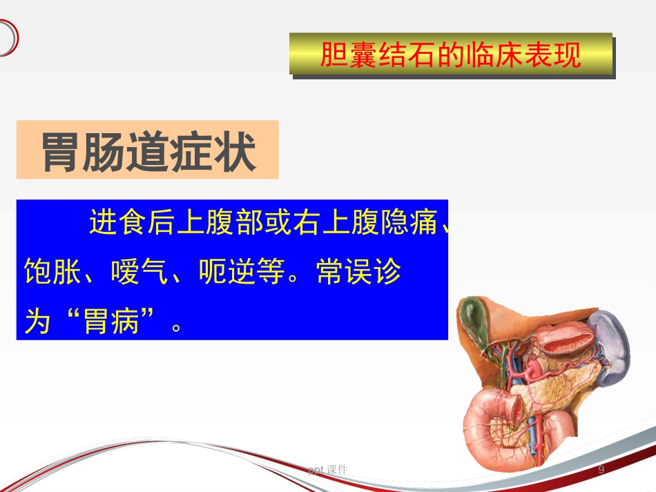 胆囊结石 ppt课件_第9页
