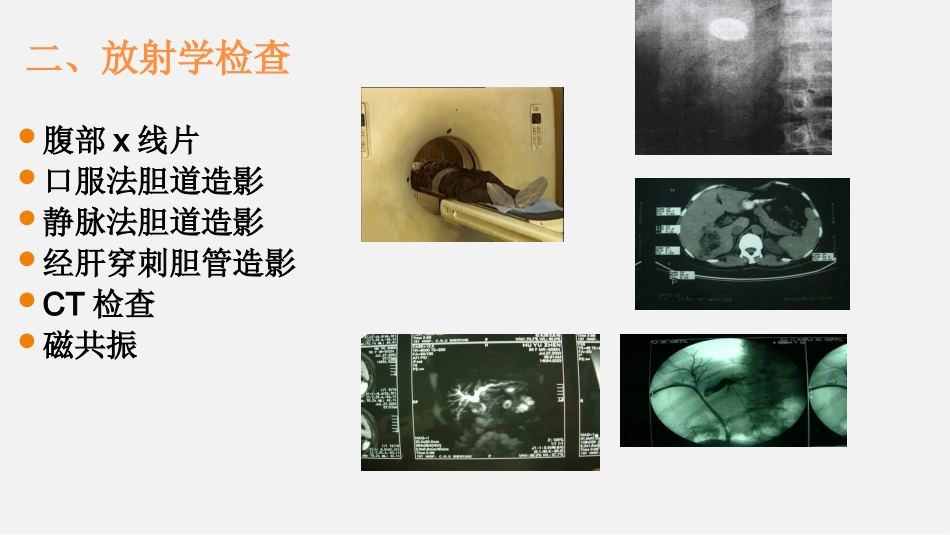 胆道疾病特殊检查ppt课件_第9页