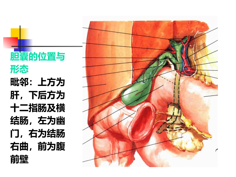 胆囊炎、胆石症课件_第6页
